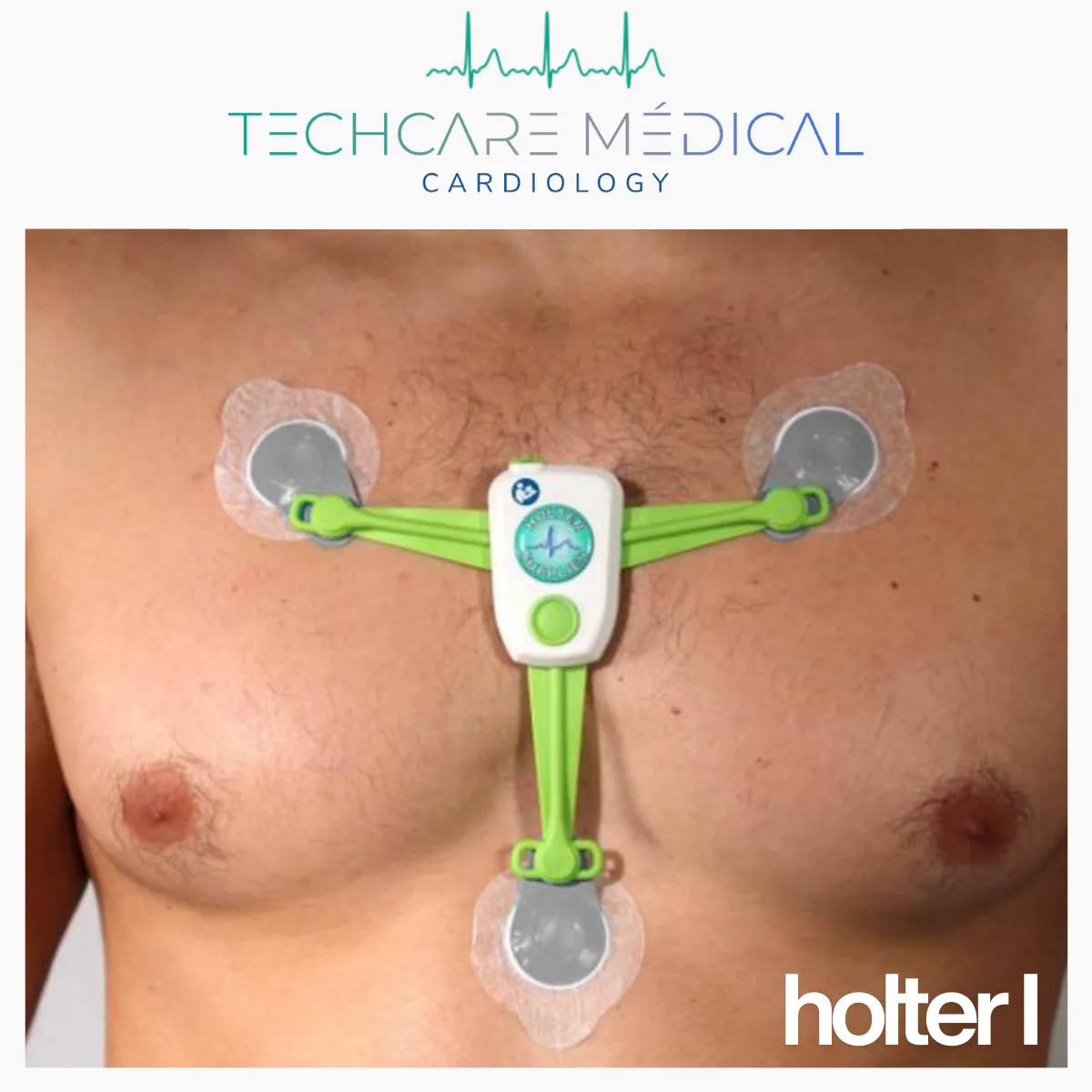 Posez le Holter.